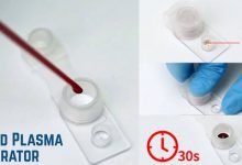 from-collection-to-therapy:-the-journey-of-blood-using-blood -plasma-separator