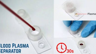from-collection-to-therapy:-the-journey-of-blood-using-blood -plasma-separator